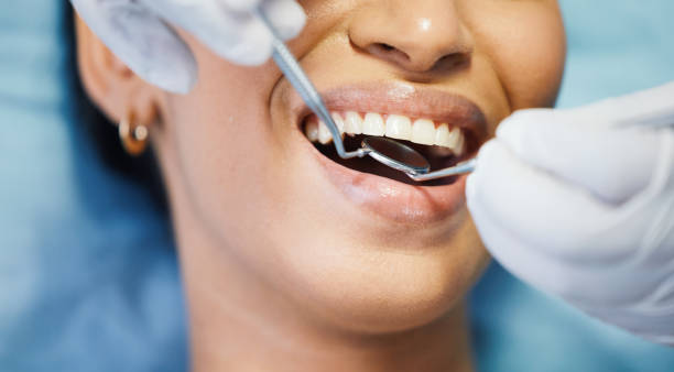 Best Cracked Tooth Emergency Dentist  in Fort Belknap Agency, MT